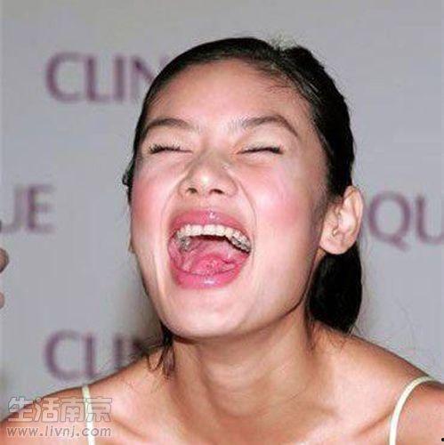 明星有谁蛀牙,口腔健康问题不容忽视